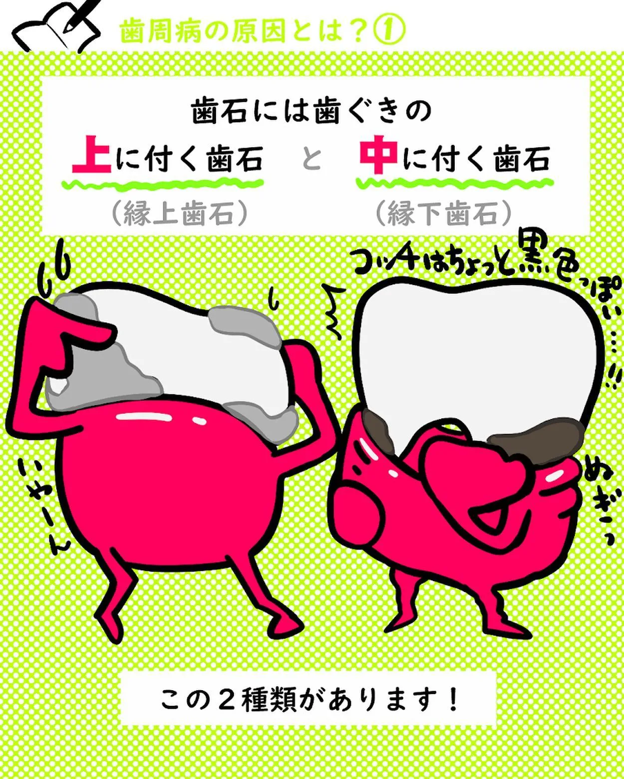 歯周病の原因とは?1️⃣🦷