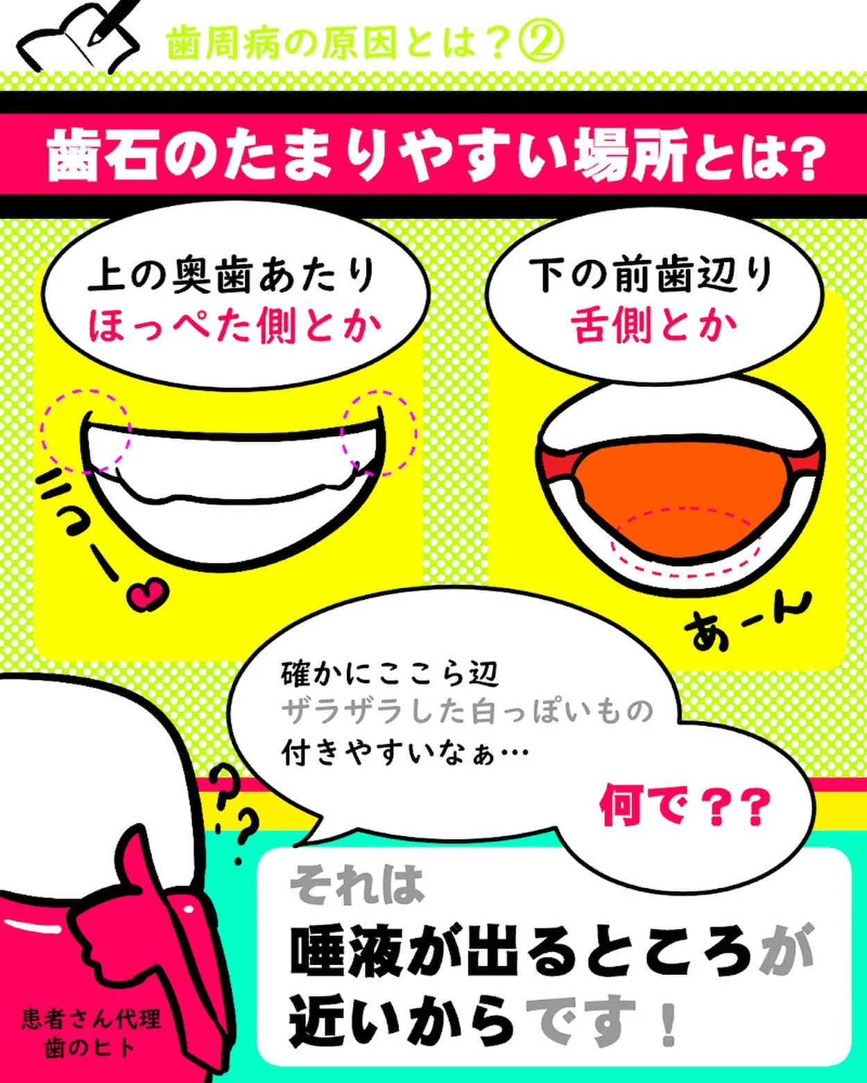 歯周病の原因とは?2️⃣