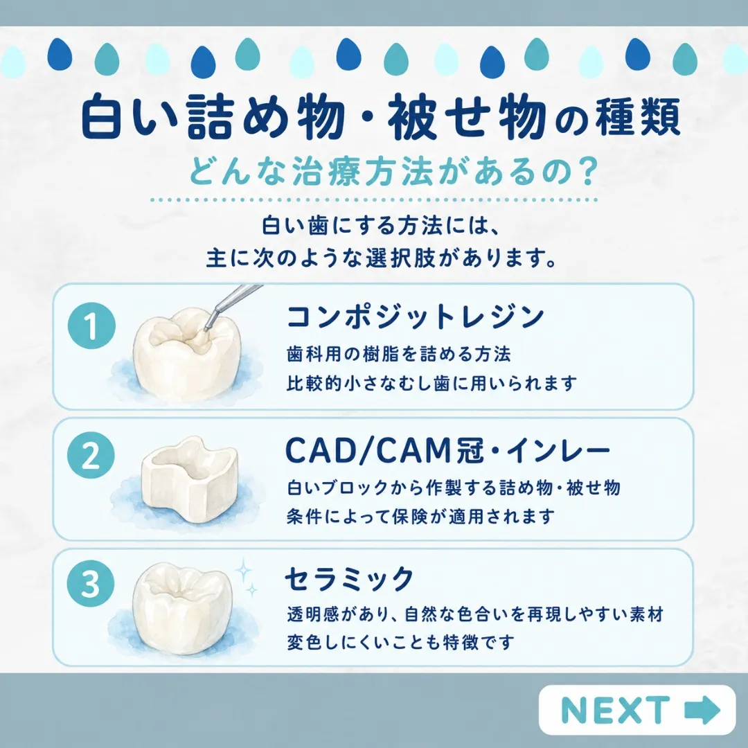 🦷銀歯が気になっていませんか？